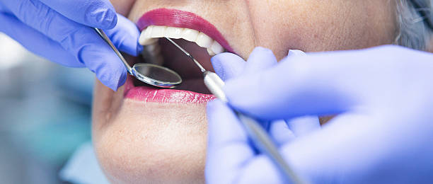 Best Emergency Tooth Extraction in Salem, IN
